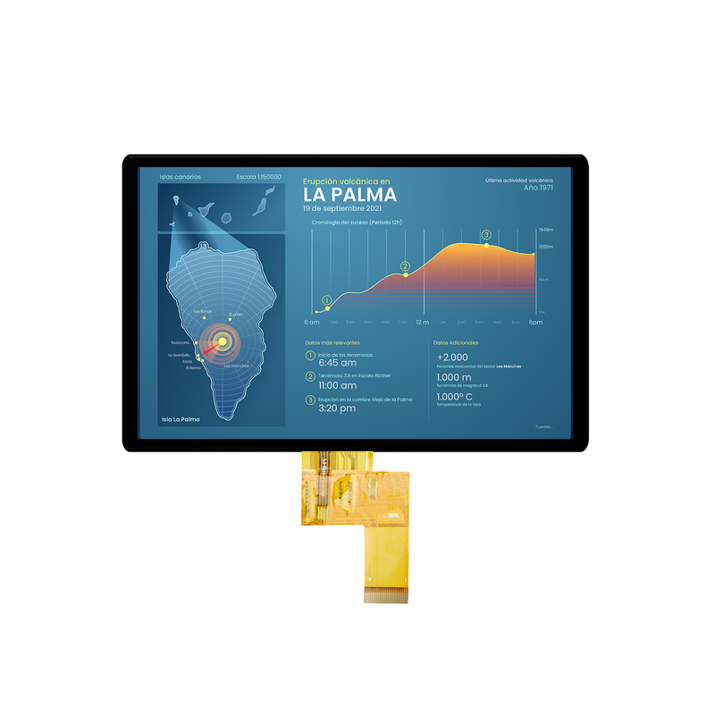의료 기기의 CTP/RTP가 포함 된 사용자 정의 TFT 모듈 고 밝기 IPS/VA TFT LCD 패널